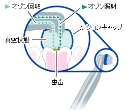 ヒールオゾン殺菌の仕組み