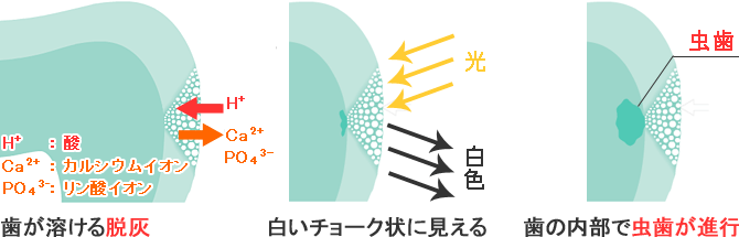 アイコンの原理