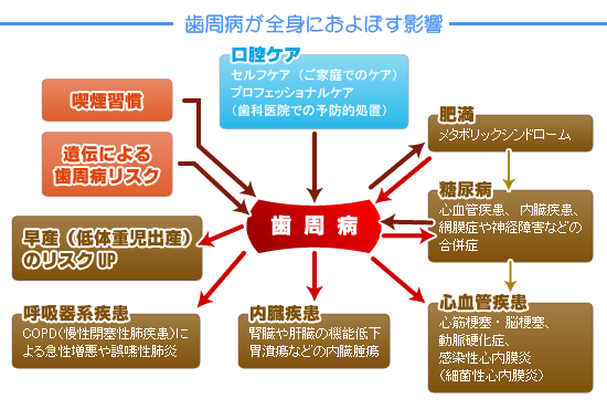 歯周病と全身の健康との関係