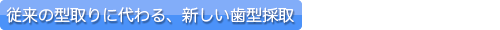 従来の型取りに代わる、新しい歯型採取）