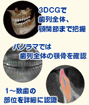 歯科用CT・パノラマレントゲン装置