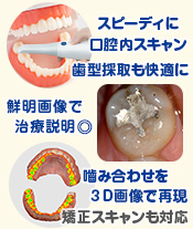 光学印象・口腔内スキャナー導入